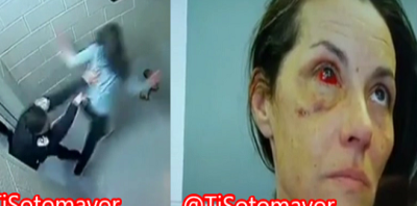 Snow Queen Gets Her Eye Orbital, Nose & Face Broken By Brutal White Boy Cops!  (Video)