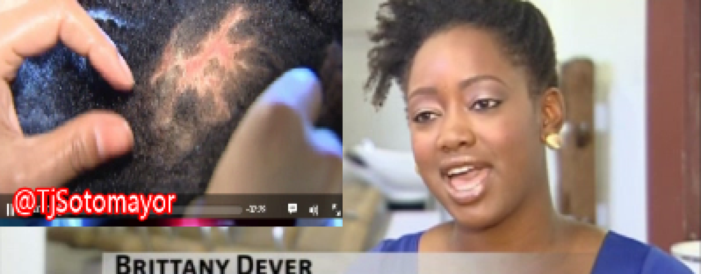 Black Women Are Suffering Hair Loss & Horrible Scalp Sores After Buying Stolen Hair Extensions! (Video)