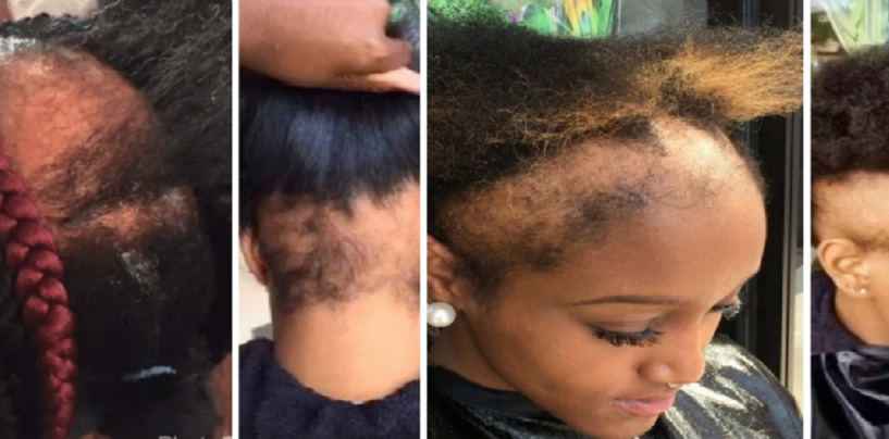 Should Black Men Just Date Non-Black Women To Rid Blacks Of The Need For Weave? (Video)