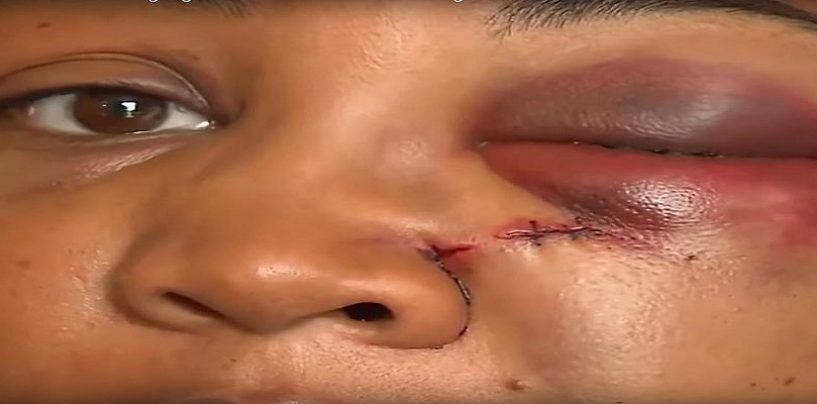 Woman Gets Face Broken By Manager At McDonalds After Complaining About Her Order! (Video)