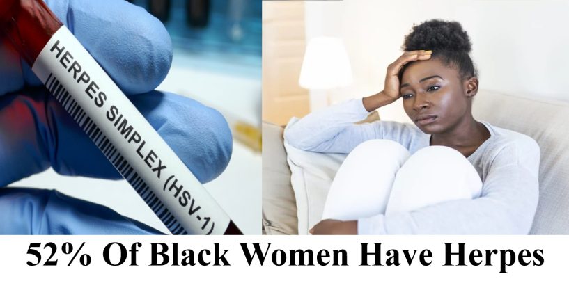 52% Of Black Women Have Genital Herpes! What Does This Say About Them To You? Lets Talk About It! (Live Twitter Space Show)