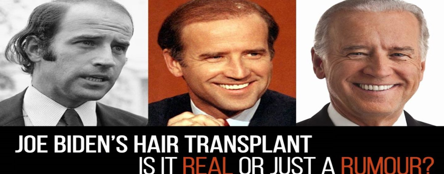 Joe Biden’s Hair From 1979 to 2024 The Greatest Comeback Story In History! LOL (Video)