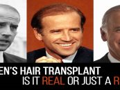 Joe Biden’s Hair From 1979 to 2024 The Greatest Comeback Story In History! LOL (Video)