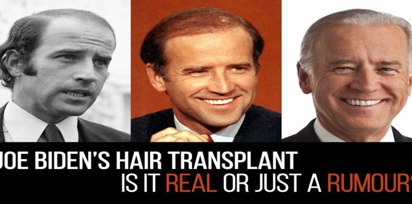 Joe Biden’s Hair From 1979 to 2024 The Greatest Comeback Story In History! LOL (Video)